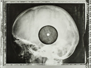 Illustration for article titled Soviet-era bootleg recordings made on discarded X-ray plates